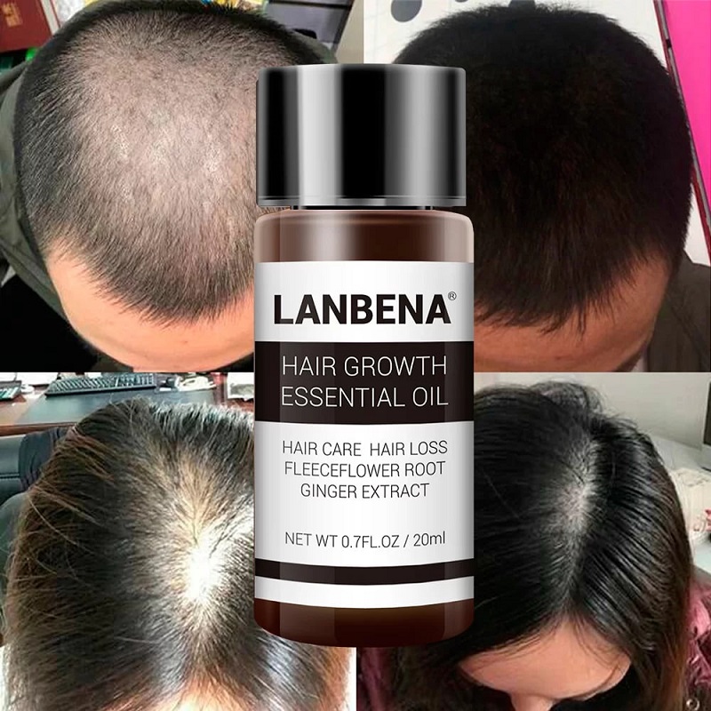 خرید اینترنتی پستی روغن رشد مو و ریش لانبنا LANBENA
